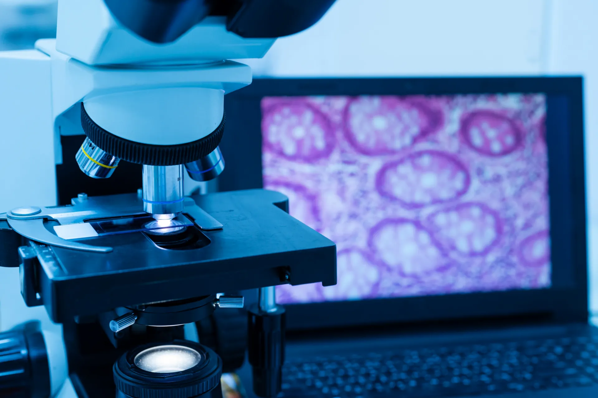 microscope looking at cancer slidees