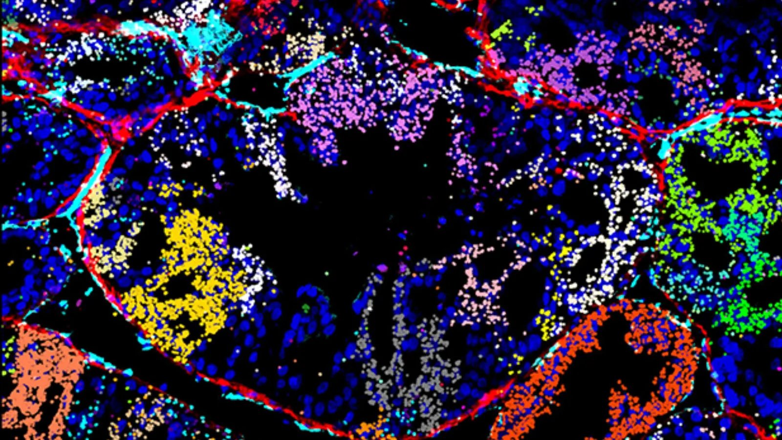 Visualization of in vivo CRISPRmap barcode detection on a xenograft tumor section, showing the guide distribution in the tumor microenvironment. Decoded CRISPR guide-identifying barcodes detected by CRISPRmap are shown as spots false-colored according to their guide identity.