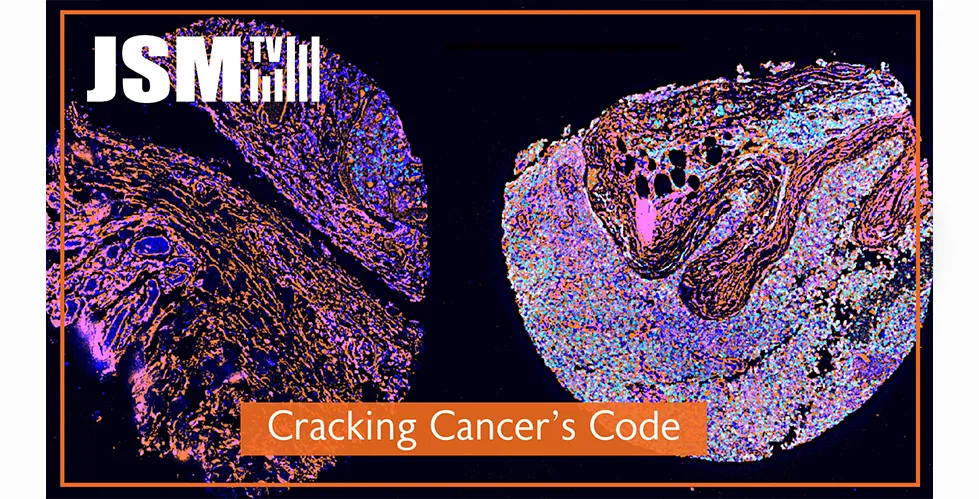 Colorful microscopic image of cancer tissue with text ‘JSM TV’ and ‘Cracking Cancer’s Code.