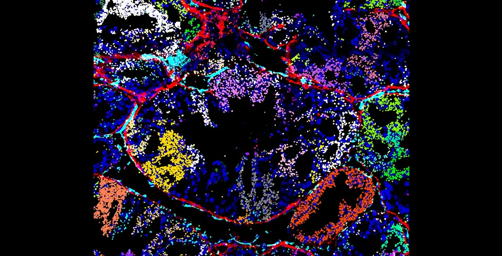 Visualization of in vivo CRISPRmap barcode detection on a xenograft tumor section, showing the guide distribution in the tumor microenvironment. Decoded CRISPR guide-identifying barcodes detected by CRISPRmap are shown as spots false-colored according to their guide identity.