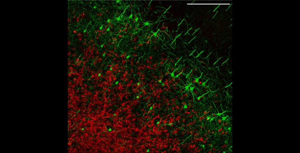 Representative field of the tumor-infiltrated cortex (glioma cells: mCherry; red) of a Thy1-EGFP-M mouse (neurons; green), scale bar: 250 mm.