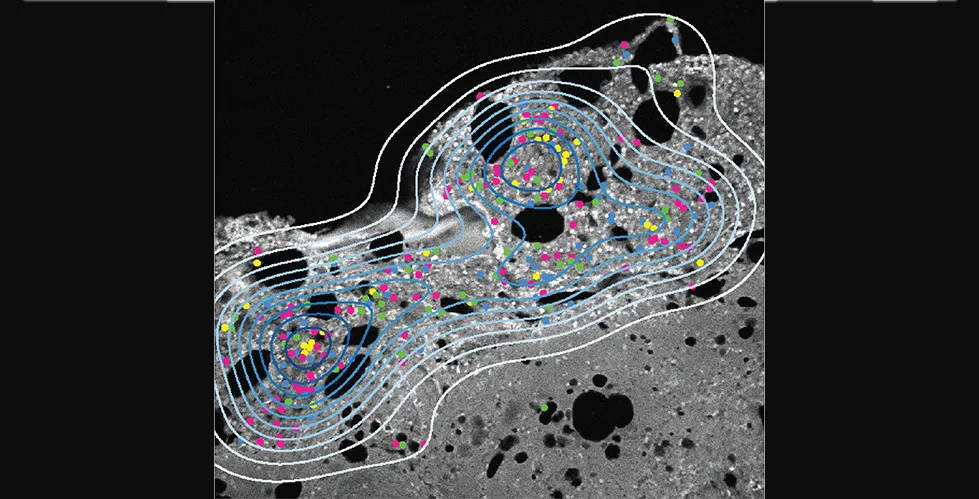 This image highlights key findings from the analysis. It represents a responder's pre-treatment sample, showcasing a variety of cell types, indicated by the diverse array of colored dots.