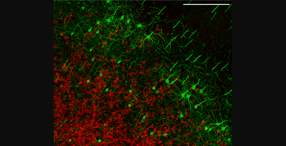 The image is a representative field of the tumor-infiltrated cortex (glioma cells: mCherry; red) of a Thy1-EGFP-M mouse (neurons; green), scale bar: 250 mm (Photo credit: Canoll Lab).